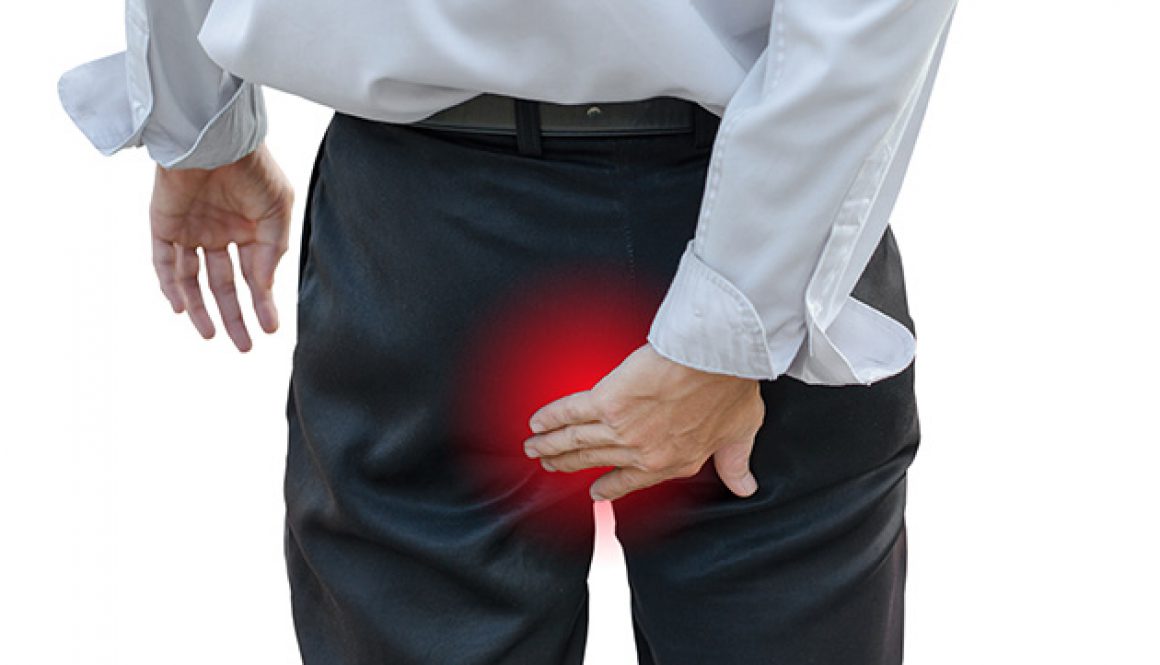 [痔疮]是怎么引起的，到底谁是“凶手”？