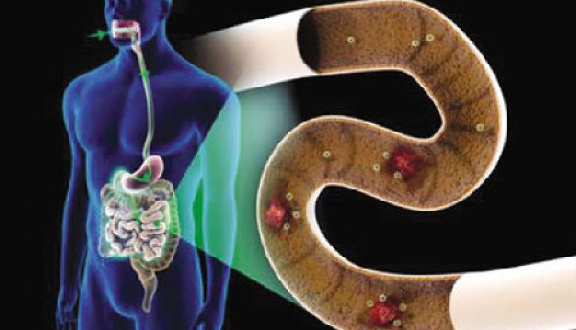 养好菌　消肠气